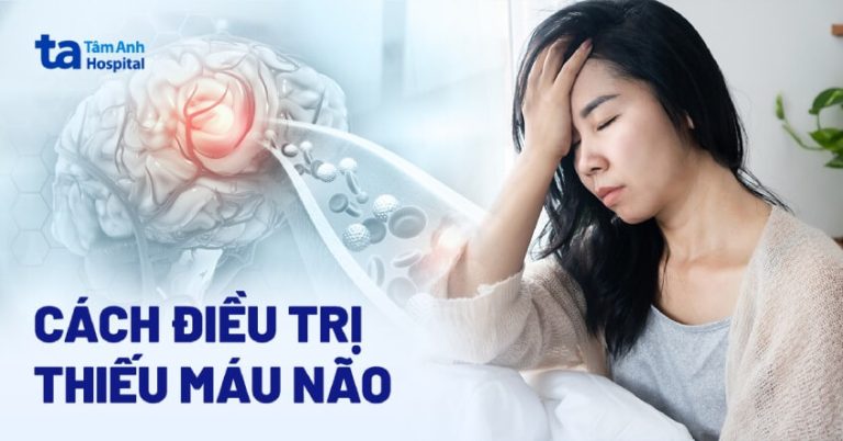 Cách điều trị thiếu máu não theo phương pháp hiện đại và tại nhà