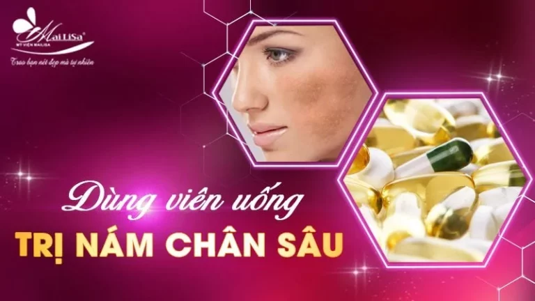 Nguyên Nhân Và Kinh Nghiệm Trị Nám Chân Sâu