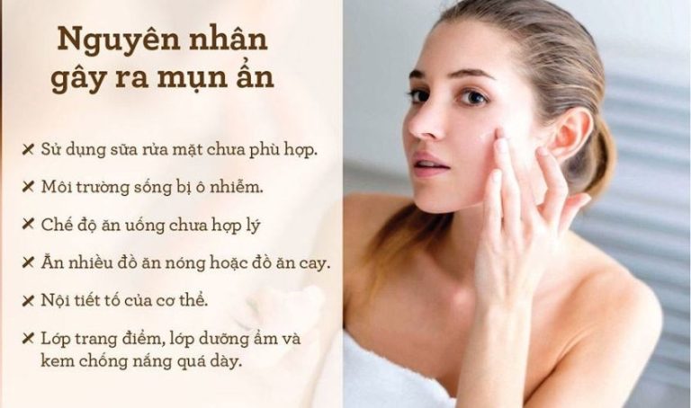 Mụn ẩn có nên nặn không? Hướng dẫn cách chăm sóc da mặt sau khi nặn