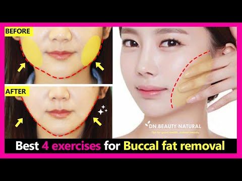 Best 4 exercises for Buccal Fat (Cheek fat) Removal naturally. How ...