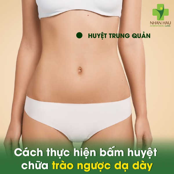 5 huyệt bấm chữa trào ngược dạ dày hiệu quả