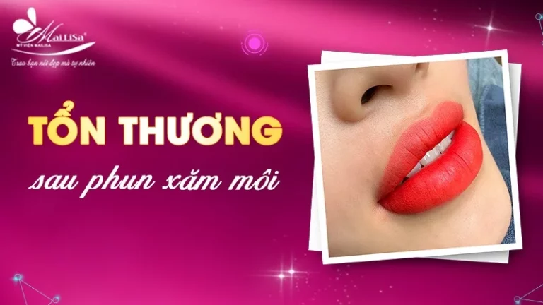 Cách Chăm Sóc Môi Sau Phun Tránh Bị Nhiễm Trùng