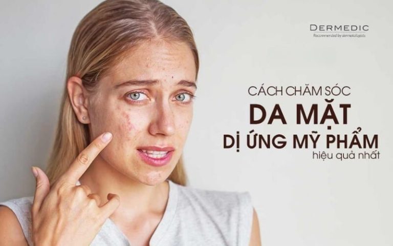 HƯỚNG DẪN CHĂM SÓC LÀN DA BỊ DỊ ỨNG MỸ PHẨM HIỆU QUẢ – DERMEDIC ...