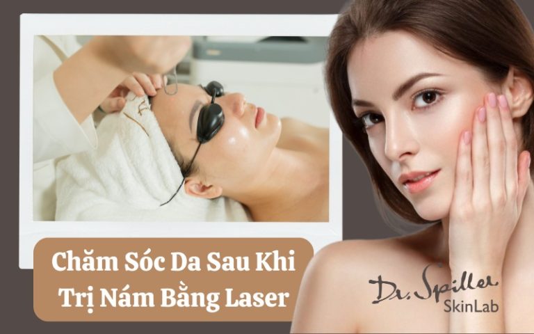 Cách chăm sóc da sau khi trị nám bằng laser giúp da mau lành