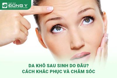 Da Khô Sau Sinh: Nguyên Nhân, Cách Khắc Phục Và Chăm Sóc