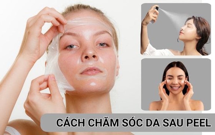 Liệu trình chăm sóc da sau peel đúng chuẩn y khoa da khỏe đẹp rạng rỡ