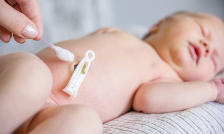 Vì sao rốn trẻ sơ sinh rụng nhưng có mủ? - Nhà thuốc FPT Long Châu