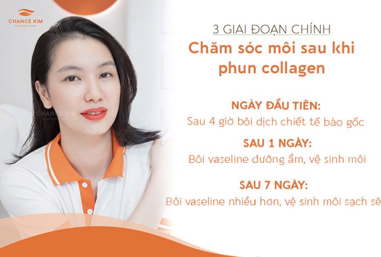 Chăm sóc môi sau khi phun collagen đúng cách