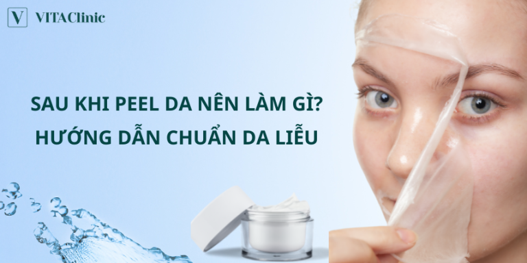 Sau khi peel da nên làm gì? Hướng dẫn chăm sóc da chuẩn da liễu