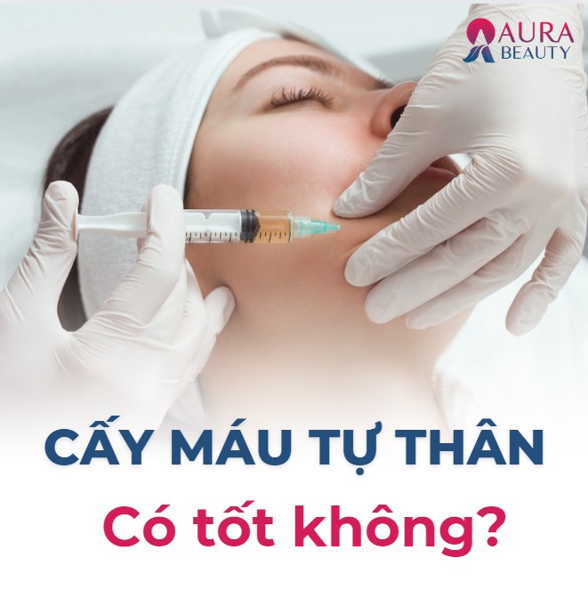 Cấy máu tự thân là gì? Cấy máu tự thân có tốt không?