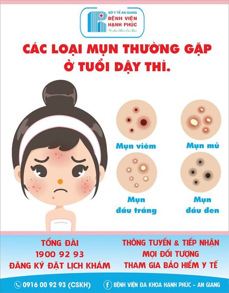 CHĂM SÓC DA MỤN TUỔI DẬY THÌ CHUẨN NHƯ BÁC SĨ HẠNH PHÚC – BỆNH ...