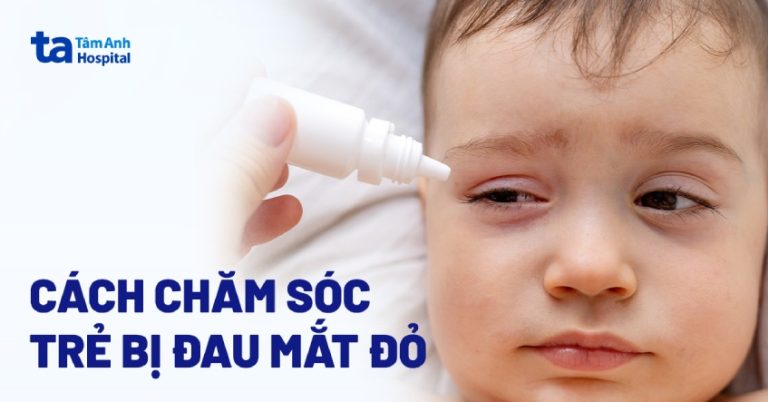 4 cách chăm sóc trẻ đau mắt đỏ tại nhà ba mẹ cần nắm rõ