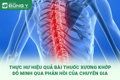 Chuyên Gia, Người Bệnh Phản Hồi Về Xương Khớp Đỗ Minh