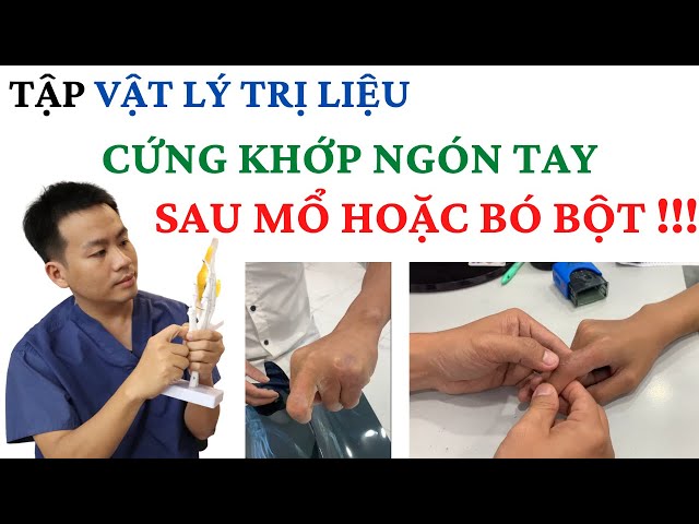 Quá trình tập vật lý trị liệu bệnh nhân bị cứng khớp ngón tay sau ...