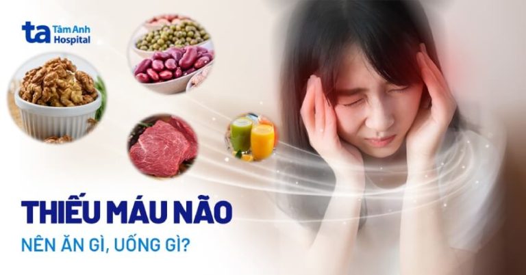 Thiếu máu não nên ăn gì? 9 thực phẩm cải thiện hiệu quả